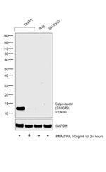 Calprotectin Antibody in Western Blot (WB)