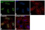 Glucocorticoid Receptor Antibody in Immunocytochemistry (ICC/IF)