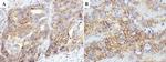 CD44v6 Antibody in Immunohistochemistry (Paraffin) (IHC (P))