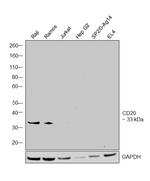 CD20 Antibody in Western Blot (WB)