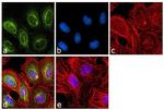 VRK1 Antibody in Immunocytochemistry (ICC/IF)