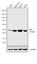 VRK1 Antibody in Western Blot (WB)