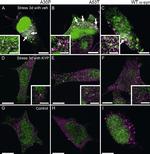 alpha Synuclein Antibody in Immunocytochemistry (ICC/IF)