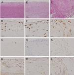 CD3e Antibody in Immunohistochemistry (IHC)