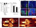 Cytokeratin 15 Antibody in Immunohistochemistry (IHC)