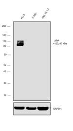 beta Amyloid Antibody in Western Blot (WB)