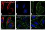 DYKDDDDK Tag Antibody in Immunocytochemistry (ICC/IF)