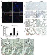 ATP Synthase beta Antibody in Immunohistochemistry (IHC)