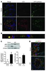 ATP Synthase beta Antibody in Immunohistochemistry (IHC)