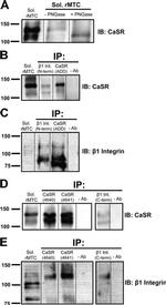 Calcium Sensing Receptor Antibody in Western Blot, Immunoprecipitation (WB, IP)