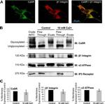 Calcium Sensing Receptor Antibody in Western Blot (WB)