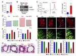 Calcium Sensing Receptor Antibody in Western Blot (WB)