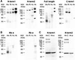 Calcium Sensing Receptor Antibody in Western Blot (WB)