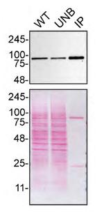 VCP Antibody in Immunoprecipitation (IP)