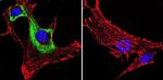 VCP Antibody in Immunocytochemistry (ICC/IF)