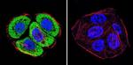 VCP Antibody in Immunocytochemistry (ICC/IF)