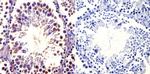 TCP1 Antibody in Immunohistochemistry (Paraffin) (IHC (P))