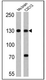 uNOS Antibody in Western Blot (WB)