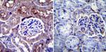 CHRNA1 Antibody in Immunohistochemistry (Paraffin) (IHC (P))