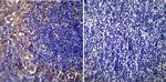 CHRNA1 Antibody in Immunohistochemistry (Paraffin) (IHC (P))