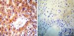 ARF1/ARF3/ARF5/ARF6 Antibody in Immunohistochemistry (Paraffin) (IHC (P))