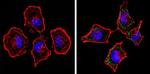 SPTBN1 Antibody in Immunocytochemistry (ICC/IF)