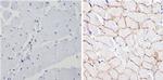 SPTBN1 Antibody in Immunohistochemistry (Paraffin) (IHC (P))