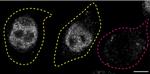 FUS Antibody in Immunocytochemistry (ICC/IF)