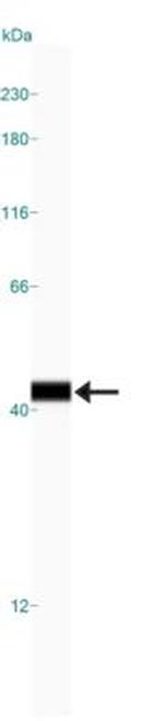 AIP Antibody in Western Blot (WB)