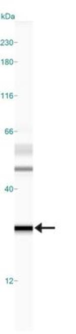 MGMT Antibody in Western Blot (WB)