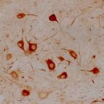 alpha Internexin Antibody in Immunohistochemistry (Paraffin) (IHC (P))