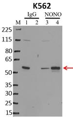 NONO Antibody in RNA Immunoprecipitation (RIP)