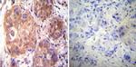 Estrogen Receptor alpha Antibody in Immunohistochemistry (Paraffin) (IHC (P))