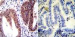 Estrogen Receptor alpha Antibody in Immunohistochemistry (Paraffin) (IHC (P))