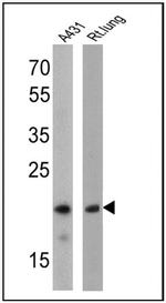 Caveolin 1 Antibody in Western Blot (WB)