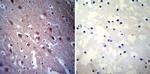 CRMP5 Antibody in Immunohistochemistry (Paraffin) (IHC (P))