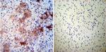 CRMP5 Antibody in Immunohistochemistry (Paraffin) (IHC (P))