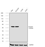 Vimentin Antibody in Western Blot (WB)