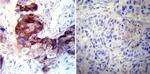 CRABP1 Antibody in Immunohistochemistry (Paraffin) (IHC (P))