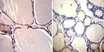 CRABP1 Antibody in Immunohistochemistry (Paraffin) (IHC (P))