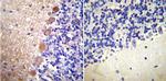 Calmodulin Antibody in Immunohistochemistry (Paraffin) (IHC (P))