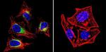 SERCA2 ATPase Antibody in Immunocytochemistry (ICC/IF)