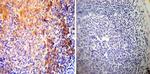 SERCA2 ATPase Antibody in Immunohistochemistry (Paraffin) (IHC (P))