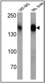 CACNA2D1 Antibody in Western Blot (WB)