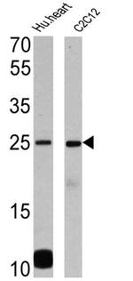 Phospholamban Antibody in Western Blot (WB)