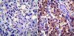 ATP1A1 Antibody in Immunohistochemistry (IHC)