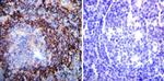 ATP1A1 Antibody in Immunohistochemistry (Paraffin) (IHC (P))