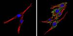 Synaptojanin 1 Antibody in Immunocytochemistry (ICC/IF)