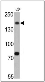 Synaptojanin 1 Antibody in Western Blot (WB)