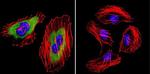 Calpain 2 Antibody in Immunocytochemistry (ICC/IF)